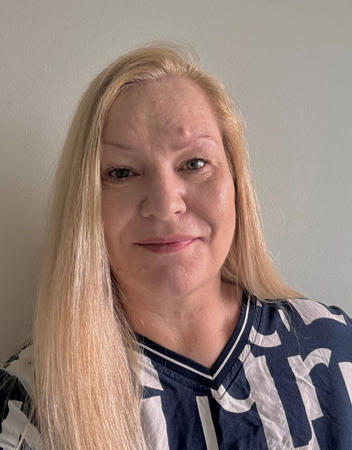 Lene Hinz-Berg